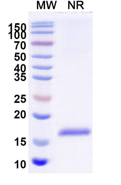Anti-Chick LYZ/Lysozyme C Recombinant Nanobody (SAA0896) - SDS-PAGE