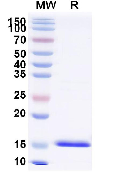 Anti-Chick LYZ/Lysozyme C Recombinant Nanobody (SAA0898) - SDS-PAGE