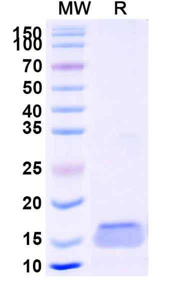Anti-Human CD284/TLR4 Recombinant Nanobody (SAA1263) - SDS-PAGE