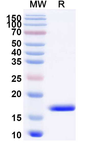 Anti-Human CXCL11/I-TAC Recombinant Nanobody (SAA1272) - SDS-PAGE