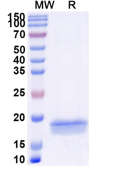 Anti-Human AURKA Recombinant Nanobody (SAA1200) - SDS-PAGE