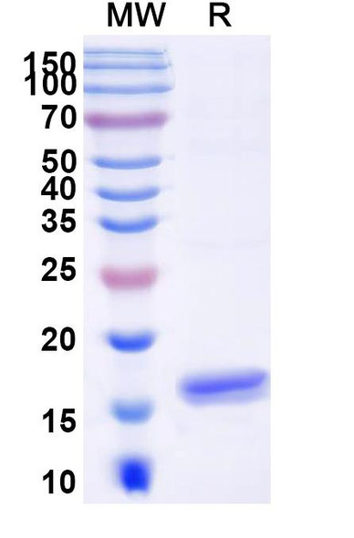 Anti-Human ANGPT2/Ang2 Recombinant Nanobody (SAA1255) - SDS-PAGE