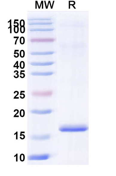 Anti-Human MAPK13 Recombinant Nanobody (SAA1368) - SDS-PAGE