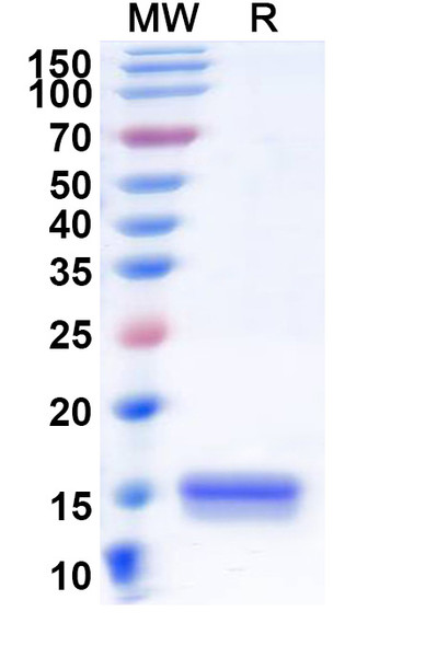 Anti-Human SYNJ1 Recombinant Nanobody (SAA1056) - SDS-PAGE