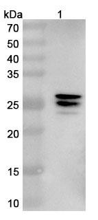 Anti-Human DCX Recombinant Nanobody (SAA1021) - WB