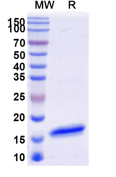 Anti-Human CD16b/FCGR3B Recombinant Nanobody (SAA1310) - SDS-PAGE