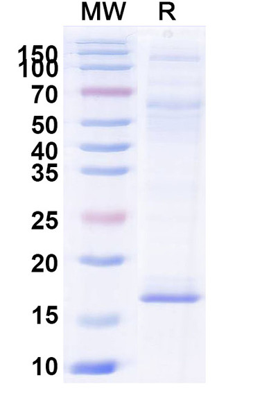 Anti-Human RECQL5 Recombinant Nanobody (SAA1003) - SDS-PAGE