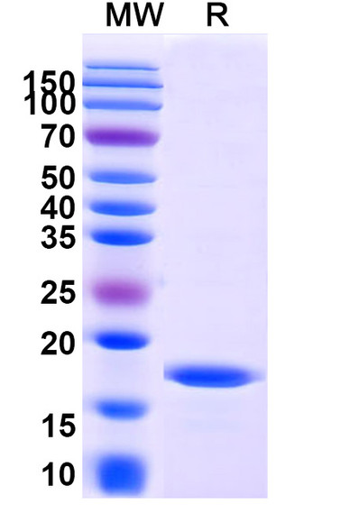 Anti-Human RECQL5 Recombinant Nanobody (SAA1014) - SDS-PAGE