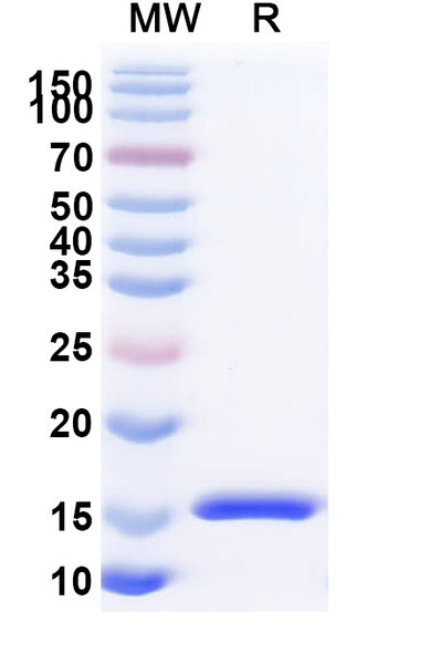 Anti-Human RECQL5 Recombinant Nanobody (SAA1131) - SDS-PAGE