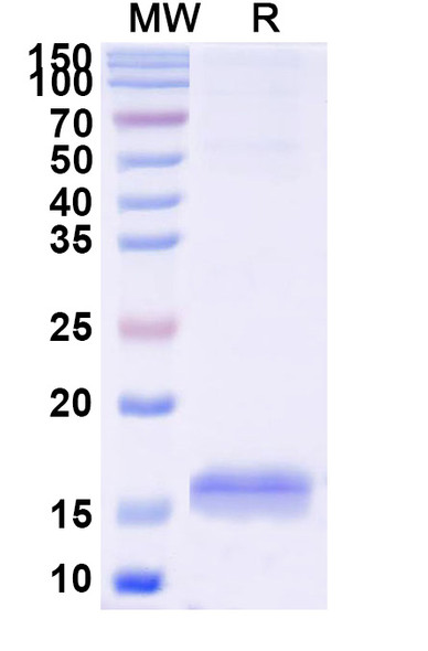 Anti-Human RECQL5 Recombinant Nanobody (SAA1132) - SDS-PAGE