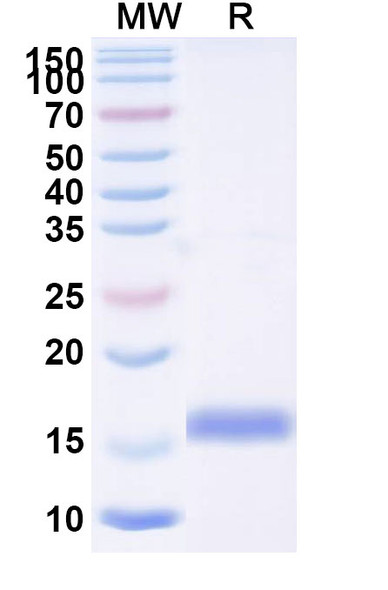 Anti-Human RECQL5 Recombinant Nanobody (SAA1134) - SDS-PAGE