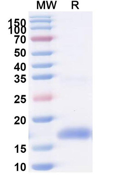 Anti-Human EGFR/ERBB1/HER1 Recombinant Nanobody (SAA0906) - SDS-PAGE