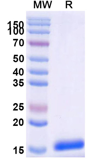 Anti-Human C3 Recombinant Nanobody (SAA0981) - SDS-PAGE