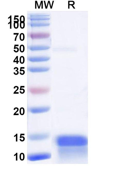 Anti-Human CALCA/Calcitonin Recombinant Nanobody (SAA1243) - SDS-PAGE