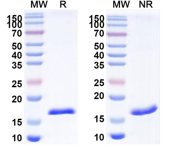 Anti-Human TG/Thyroglobulin Recombinant Nanobody (SAA1339) - SDS-PAGE