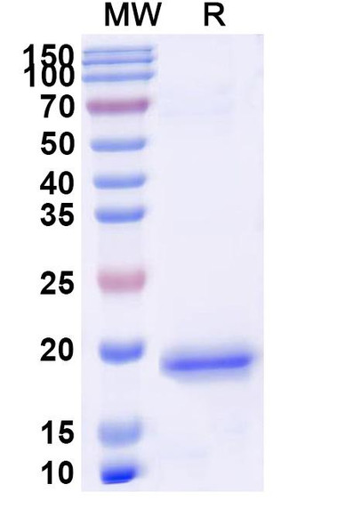 Anti-Human TNFa/TNF-alpha Recombinant Nanobody (SAA1163) - SDS-PAGE