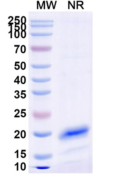 Anti-Human CD71/TFRC Recombinant Nanobody (SAA1205) - SDS-PAGE