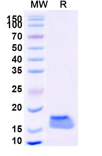 Anti-Human CAT/Catalase Recombinant Nanobody (SAA1202) - SDS-PAGE