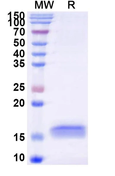 Anti-Human APP Recombinant Nanobody (SAA1209) - SDS-PAGE