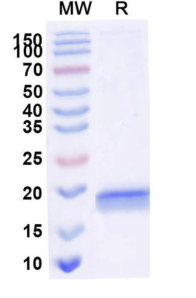 Anti-Human SERPINE1/PAI-1 Recombinant Nanobody (SAA1078) - SDS-PAGE