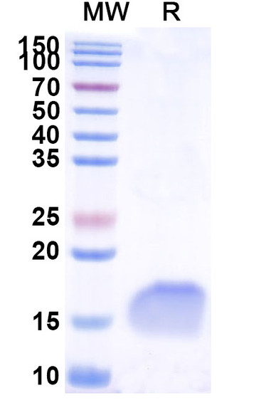 Anti-Human CD66e/CEA/CEACAM5 Recombinant Nanobody (SAA1298) - SDS-PAGE