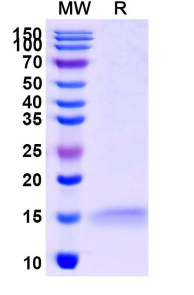Anti-Human ADRB2 Recombinant Nanobody (SAA1252) - SDS-PAGE