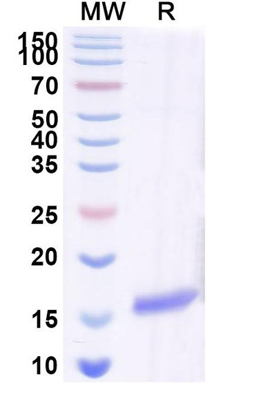 Anti-Human CHRM2 Recombinant Nanobody (SAA0920) - SDS-PAGE