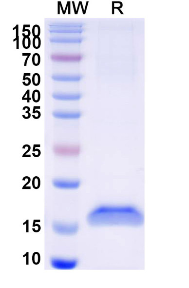 Anti-Human MET/c-Met/HGFR Recombinant Nanobody (SAA1308) - SDS-PAGE