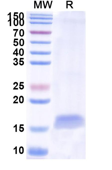 Anti-Human CD49e/ITGA5 Recombinant Nanobody (SAA1304) - SDS-PAGE
