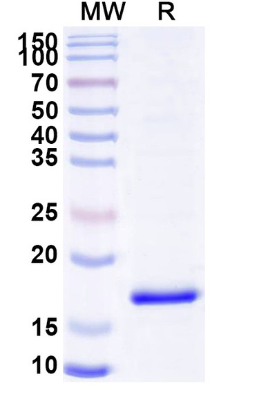 Anti-Human C4b Recombinant Nanobody (SAA0908) - SDS-PAGE