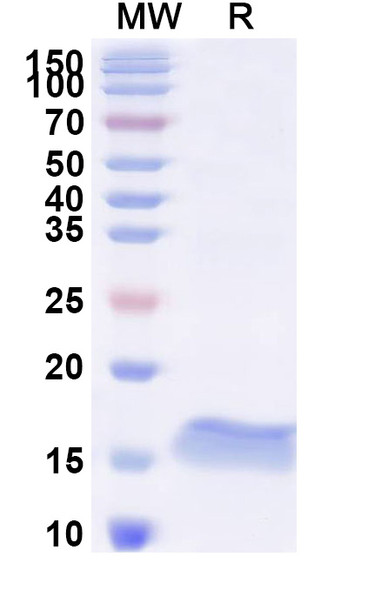 Anti-Human BCL2 Recombinant Nanobody (SAA1206) - SDS-PAGE