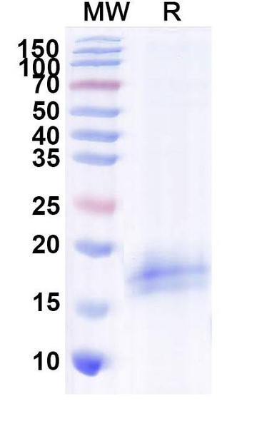 Anti-Human CFTR Recombinant Nanobody (SAA1020) - SDS-PAGE