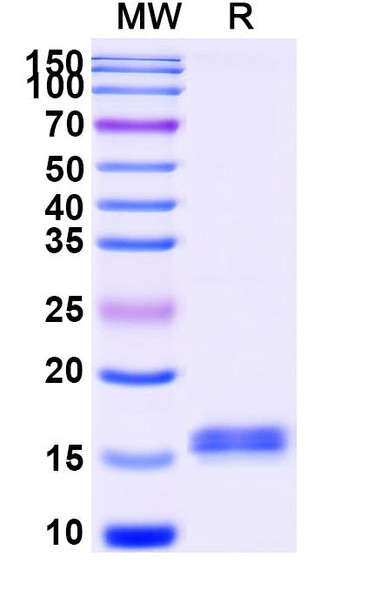 Anti-Human CFTR Recombinant Nanobody (SAA1042) - SDS-PAGE