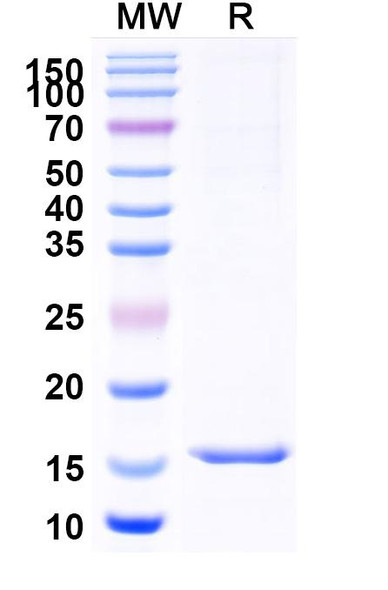 Anti-Human CD13/ANPEP/APN Recombinant Nanobody (SAA1324) - SDS-PAGE