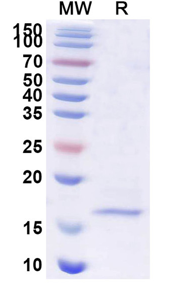 Anti-Human CD19 Recombinant Nanobody (SAA1246) - SDS-PAGE