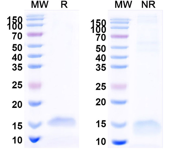 Anti-Human VEGFA Recombinant Nanobody (SAA0902) - SDS-PAGE