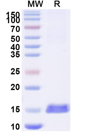 Anti-Human CD152/CTLA4 Recombinant Nanobody (SAA1054) - SDS-PAGE