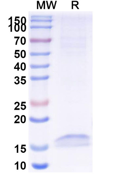 Anti-Human CD326/EPCAM Recombinant Nanobody (SAA1341) - SDS-PAGE