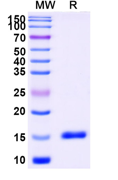 Anti-Human CD11a/ITGAL Recombinant Nanobody (SAA1305) - SDS-PAGE