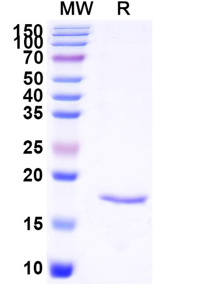 Anti-Human CNR1/CB1 Recombinant Nanobody (SAA1274) - SDS-PAGE