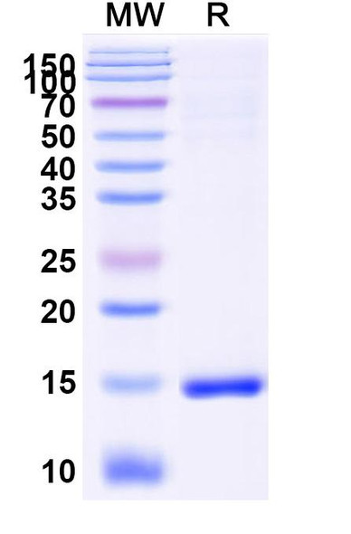 Anti-Human CD9 Recombinant Nanobody (SAA0917) - SDS-PAGE