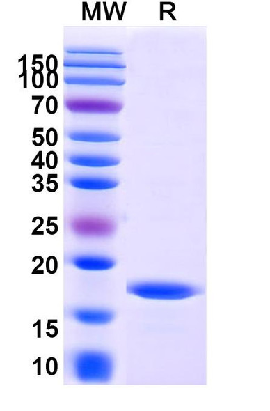 Anti-Human CD252/TNFSF4/OX40L Recombinant Nanobody (SAA1277) - SDS-PAGE