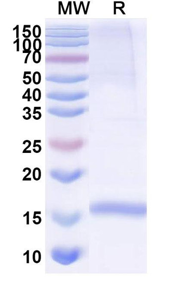 Anti-Human CD49c/ITGA3 Recombinant Nanobody (SAA1303) - SDS-PAGE