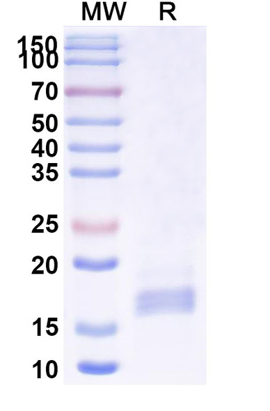 Anti-Human HTR2A Recombinant Nanobody (SAA1362) - SDS-PAGE