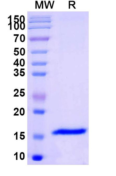 Anti-Human GABRB3 Recombinant Nanobody (SAA1162) - SDS-PAGE