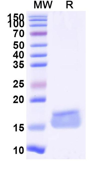 Anti-Human A2AR/ADORA2A Recombinant Nanobody (SAA1155) - SDS-PAGE