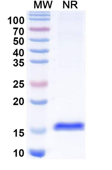 Anti-Human CTGF/CCN2 Recombinant Nanobody (SAA1211) - SDS-PAGE
