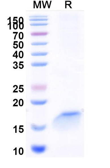 Anti-Human CD197/CCR7 Recombinant Nanobody (SAA1349) - SDS-PAGE