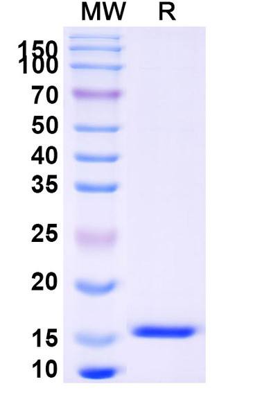 Anti-Human GPR183 Recombinant Nanobody (SAA0953) - SDS-PAGE