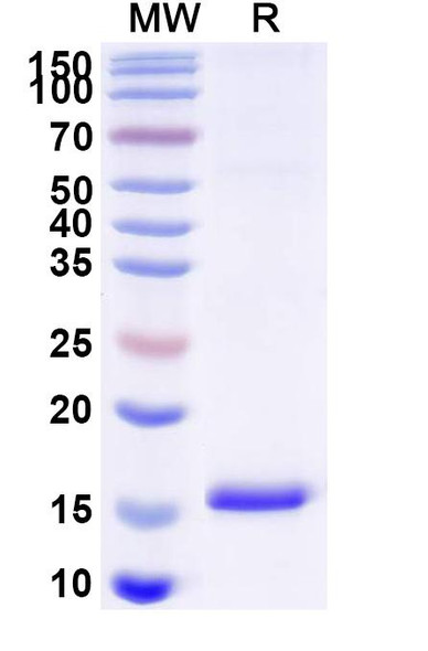 Anti-Human EPHX2 Recombinant Nanobody (SAA1372) - SDS-PAGE